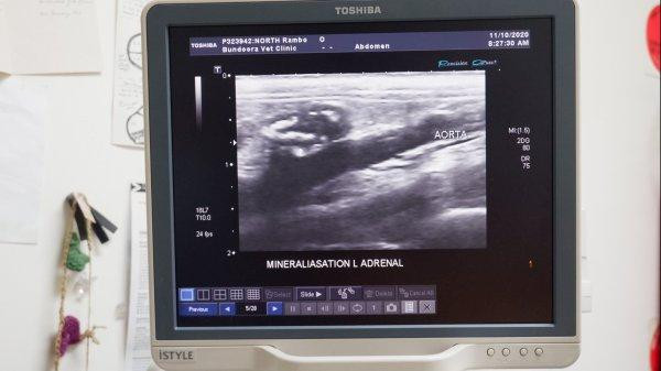 Ultrasound imaging